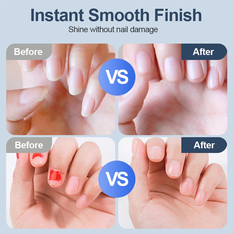🎉Electric Nail Clipper – Final 3 Hours: 60%OFF 🔥